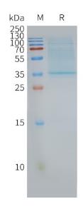 SDS-PAGE (CD63-2946H).jpg